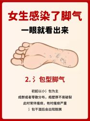 -德哥灰指甲脚气甲沟炎跖疣护理