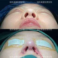 -JustHer宁波珈禾医疗美容医院