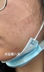 -新地崔劲松医疗美容
