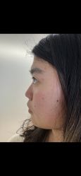 -杭州美莱医疗美容医院