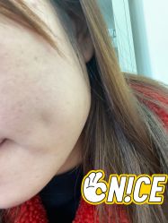 体验后-来美轻医美抗衰中心