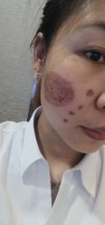 体验后-上海宏康医院·医疗美容科