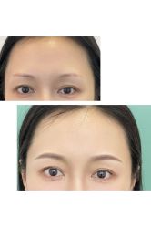 -杨益美学·野生眉半永久纹眉发际线