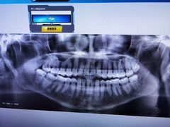 -土豆口腔(凤凰北总店)