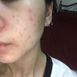 体验后-厦门美莱整形美容医院