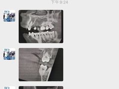 -精德口腔·种植修复·儿牙中心(财富中心店)