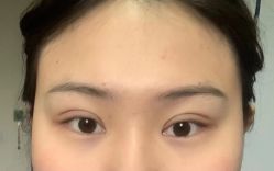 -素美医疗美容·西南眼鼻整形·修复基地