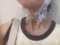 -八大处整形