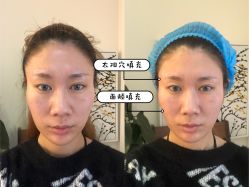 -天津伊美尔医疗整形美容专科医院