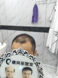 -唐风采假发补发定制