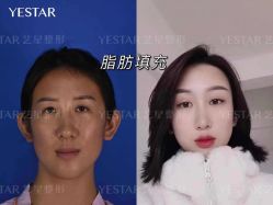 -Yestar艺星医疗美容医院