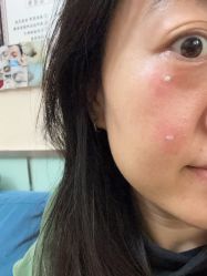 -北京美痣堂古方祛痣斑疣瘊