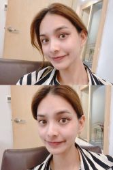 -丽美妍医疗美容·皮秒·立体分层抗衰