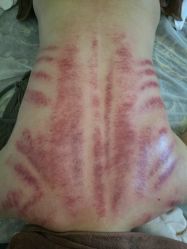 -悦艾堂·中医拔罐减肥·美体艾灸连锁