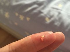 -优护佳医护级月嫂(和睦家浦西店)