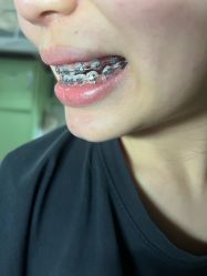 -广州美莱医疗美容医院