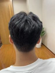 -大麦微针植发全国连锁