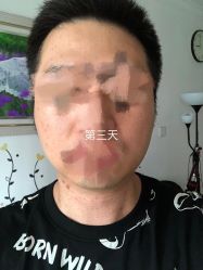 -爱莎扁平疣·汗管瘤·斑痣中心