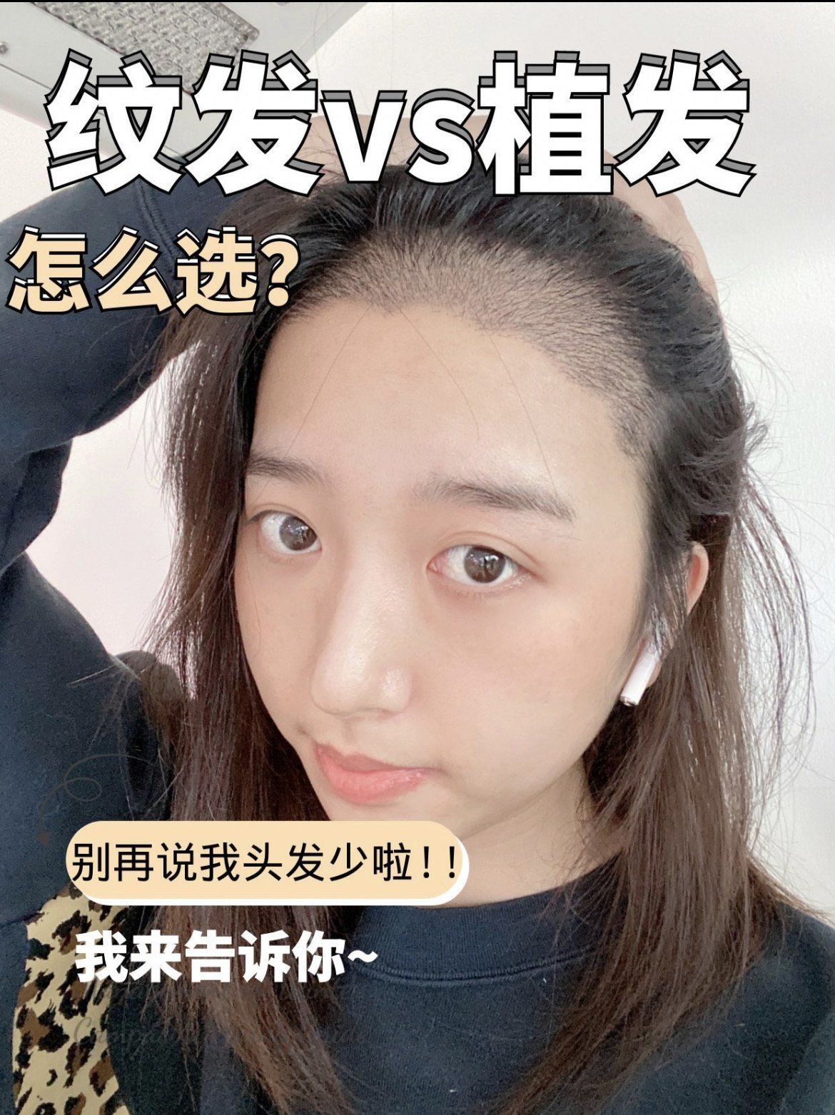 植发vs纹发:选择哪个才是王道