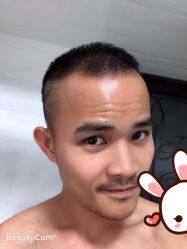 点击看大图 -大麦微针植发丨全国连锁