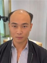 -发饰美男士增发补发假发定制店