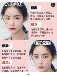 -凡碧诗毛孔清洁收细