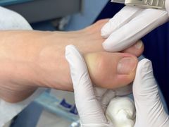 -Andrew指甲专科灰指甲·甲沟炎矫正·3D步态矫形鞋垫定制(上海法华镇路旗舰店)