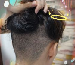 -大麦微针植发全国连锁