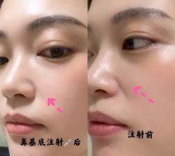 -安徽合肥韩美整形外科医院
