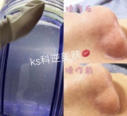 点击看大图 -KS科逆美肤祛痘