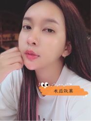-长沙雅美医疗美容医院
