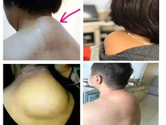 -深蓝盲人推拿·颈肩腰腿疼痛·艾灸调理(清河店)