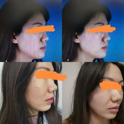 点击看大图 体验前-青岛诺德医学美容医院