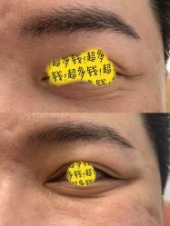 体验前-中加科洋医疗美容