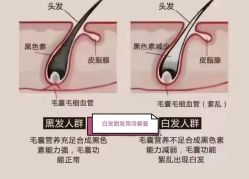 -诗碧曼养发