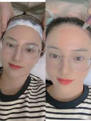 -MISS STAR·半永久纹眉·发际线·美瞳线