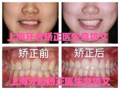 -牙博士口腔品牌连锁(杨浦店)