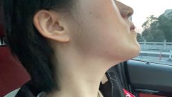 点击看大图 体验后-杭州奥拉克医疗美容门诊部