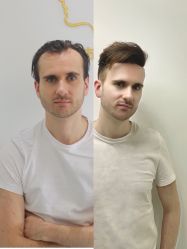 -发饰美男士增发补发假发定制店