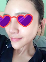-广州美莱医疗美容医院