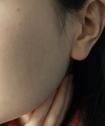 -长沙雅美医疗美容医院