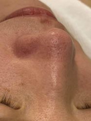 -苑苑vbeauty科技美容SPA