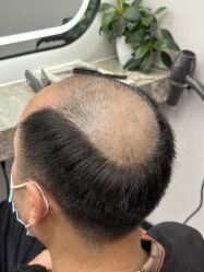 -唐风采假发补发定制