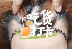 -大麦微针植发全国连锁