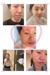 -针美汇欧邦医疗美容