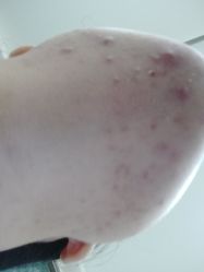 -比华利美容医院