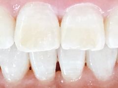 -Dr.Z dental仁康种植矫正中心