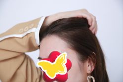 -大麦微针植发丨全国连锁