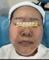 体验前-厦门美莱整形美容医院