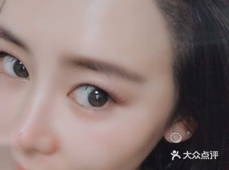 女性掉头发，当心多囊卵巢综合征！